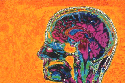 brain scan